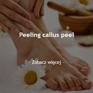 Peeling Callus Peel
