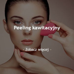 Peeling kawitacyjny